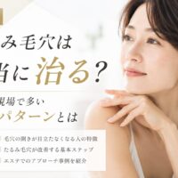 三田市でたるみ毛穴改善を目指す女性向けに、エステ現場で多い改善パターンを紹介しているアイキャッチ画像