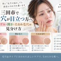 三田市で毛穴が目立つ方へ、黒ずみ毛穴・開き毛穴・たるみ毛穴の特徴と見分け方を紹介するアイキャッチ画像