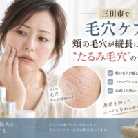 三田市で頬の縦長毛穴が気になる方へ、たるみ毛穴のサインと毛穴ケアを紹介するアイキャッチ画像
