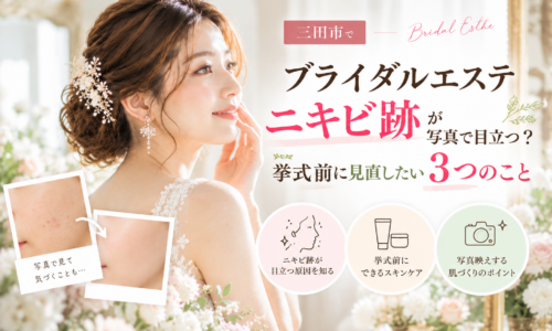 三田市でブライダルエステを検討するニキビ跡が気になる花嫁へ、写真で目立つ理由と挙式前のスキンケアを紹介するアイキャッチ画像