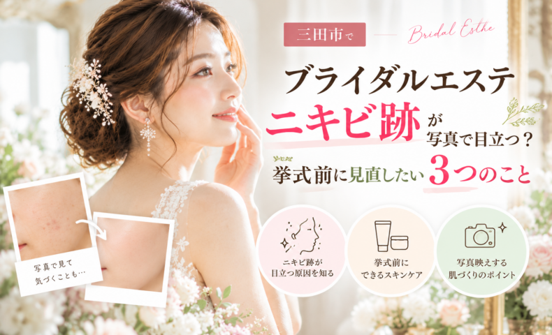 三田市でブライダルエステを検討するニキビ跡が気になる花嫁へ、写真で目立つ理由と挙式前のスキンケアを紹介するアイキャッチ画像
