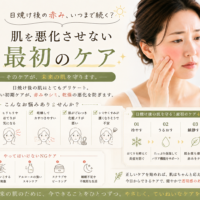 三田市で日焼け後の赤みが気になる人へ、肌を悪化させないための最初のケアを紹介するアイキャッチ画像