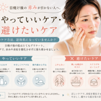 三田市で日焼け後の赤みが引かない人へ、やっていいケアと避けたいケアを紹介するアイキャッチ画像