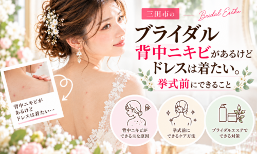 三田市でブライダルエステを検討する花嫁へ、背中ニキビが気になるときの挙式前ケアを紹介するアイキャッチ画像