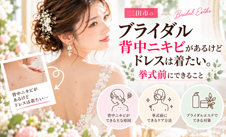 三田市でブライダルエステを検討する花嫁へ、背中ニキビが気になるときの挙式前ケアを紹介するアイキャッチ画像
