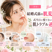 三田市で結婚式を控える花嫁さんへ、ニキビ・赤み・乾燥・かゆみなどの肌荒れ対策と、挙式6ヶ月前から当日までのスキンケアスケジュールを紹介するアイキャッチ画像