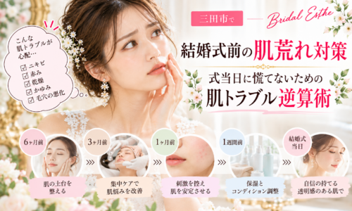 三田市で結婚式を控える花嫁さんへ、ニキビ・赤み・乾燥・かゆみなどの肌荒れ対策と、挙式6ヶ月前から当日までのスキンケアスケジュールを紹介するアイキャッチ画像
