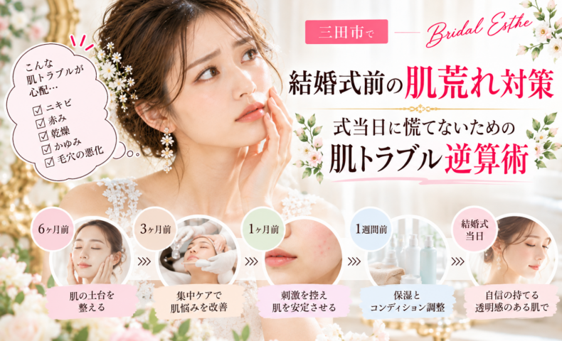 三田市で結婚式を控える花嫁さんへ、ニキビ・赤み・乾燥・かゆみなどの肌荒れ対策と、挙式6ヶ月前から当日までのスキンケアスケジュールを紹介するアイキャッチ画像