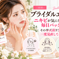 三田市のブライダルエステ｜ニキビが気になり毎日パックをしている花嫁さんへ、ニキビの原因や挙式前に見直したいスキンケアを紹介するアイキャッチ画像