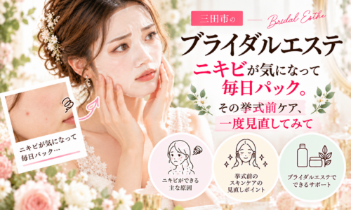 三田市のブライダルエステ|ニキビが気になり毎日パックをしている花嫁さんへ、ニキビの原因や挙式前に見直したいスキンケアを紹介するアイキャッチ画像