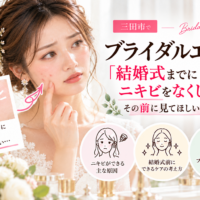 三田市でブライダルエステを検討中の花嫁さんへ。結婚式までにニキビをなくしたい方に向けて、ニキビの原因や挙式前のスキンケアを紹介するアイキャッチ画像