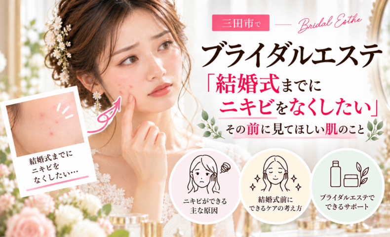 三田市でブライダルエステを検討中の花嫁さんへ。結婚式までにニキビをなくしたい方に向けて、ニキビの原因や挙式前のスキンケアを紹介するアイキャッチ画像